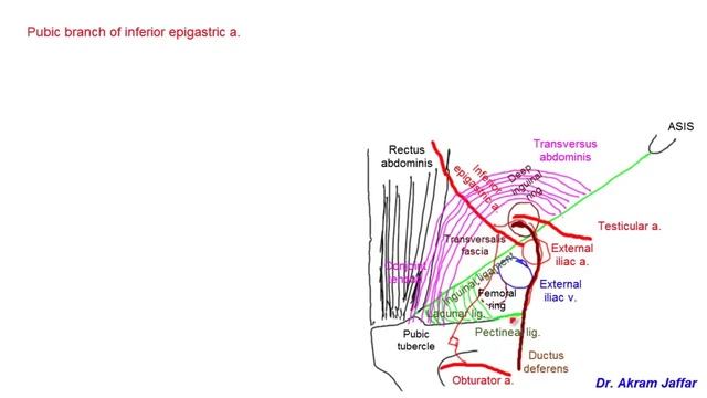 Abnormal (aberrant) obturator artery (corona mortis) смотреть онлайн