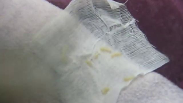 Найденный перс-опарыши в лапе и пироплазмоз смотреть онлайн