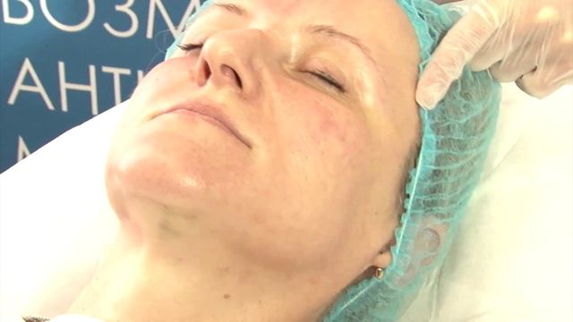 Как использовать Мэлсмон? Мастер-класс по технике введения плацентарного препарата МЭЛСМОН смотреть онлайн