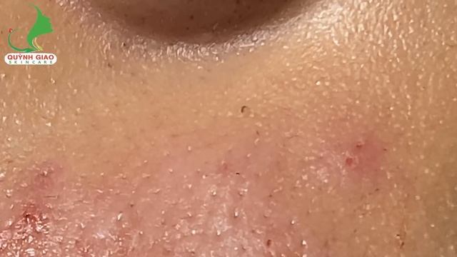 Relax Skincare Everyday With QuynhGiao Beauty Spa #218