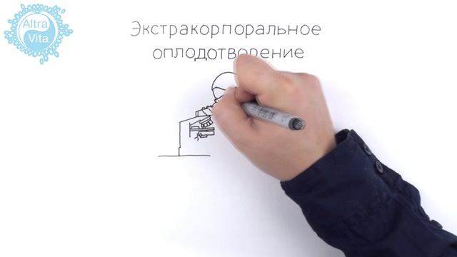 Этапы ЭКО