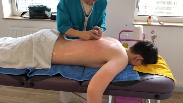 ВАКУУМНЫЙ, БАНОЧНЫЙ массаж спины