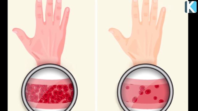 1 Стакан АЙРАНҒА 1 Қасық БАЛ ҚОСЫП ІШІҢІЗ, Қан аздықтан ҚҰТЫЛУДЫҢ ҚҰПИЯСЫ смотреть онлайн