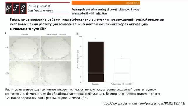 Сателлитный симпозиум "Синдром повышенной кишечной проницаемости" смотреть онлайн