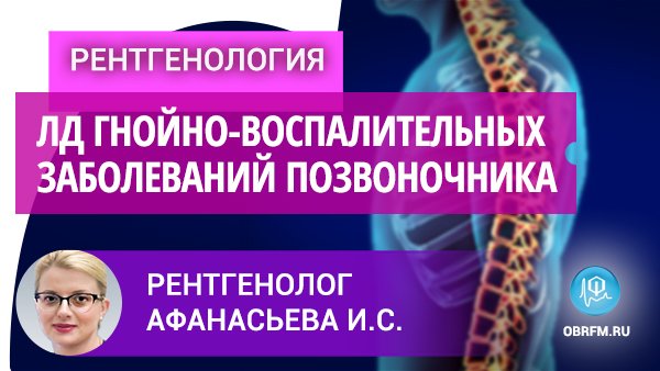 Рентгенолог Афанасьева И.С.: Луч-я ди-ка неспецифических гнойно-воспалительных заб-ний позвоночника смотреть онлайн