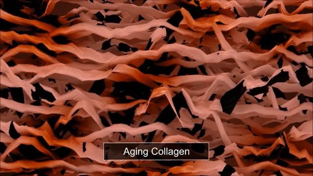 Ultraformer HIFU Facial Lifting Treatment смотреть онлайн