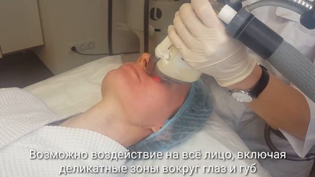 FRAXEL - омоложение в Центре инновационной косметологии ALTEOS, г. Ижевск смотреть онлайн