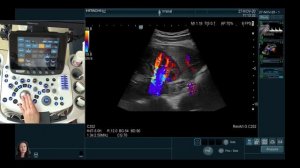 Мастер-класс по почечным артериям от профессора Гажоновой В.Е.  от 19.12.2020