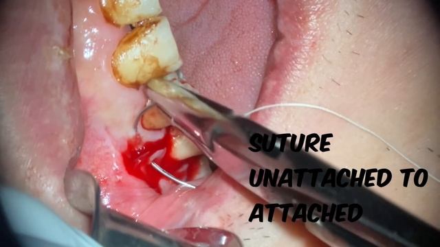 Top 10 Oral Surgery Tips to Increase Your Confidence. смотреть онлайн