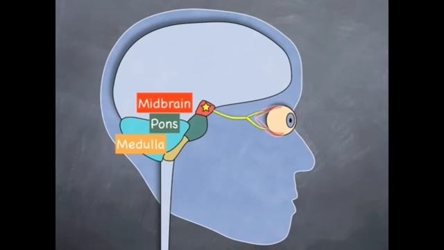 Анізокорія смотреть онлайн