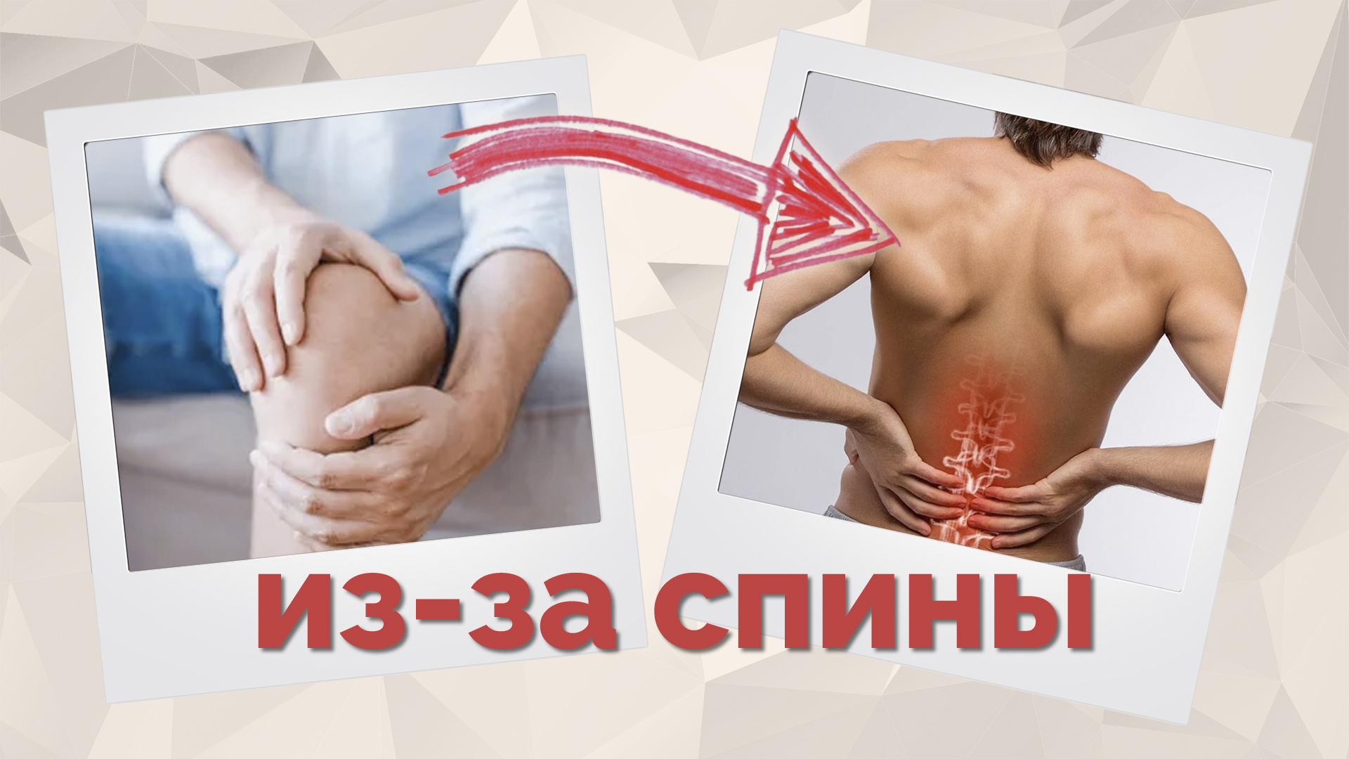 Боль в коленях и поясница. Связь? Как это лечить? смотреть онлайн