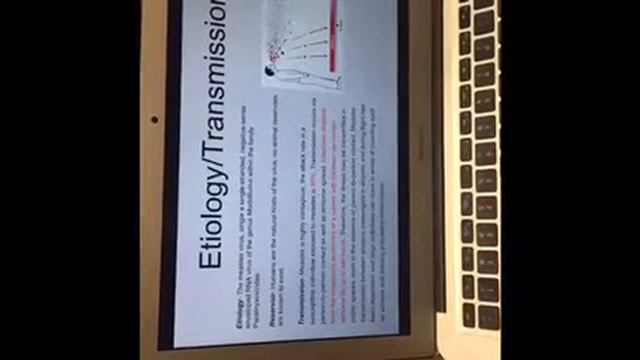 Measles Presentation смотреть онлайн