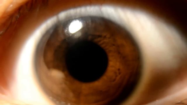 Pupil Constriction and Dilation HD Macro Nikon D5100 смотреть онлайн