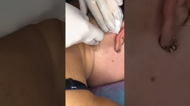 Шугаринг Затылок baby волосы смотреть онлайн