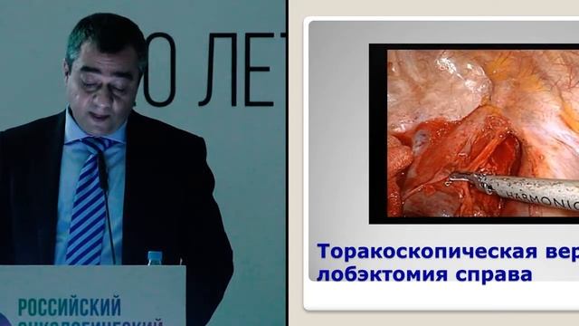 Современные возможности торакоскопии в хирургии опухолей торакальной локализации смотреть онлайн