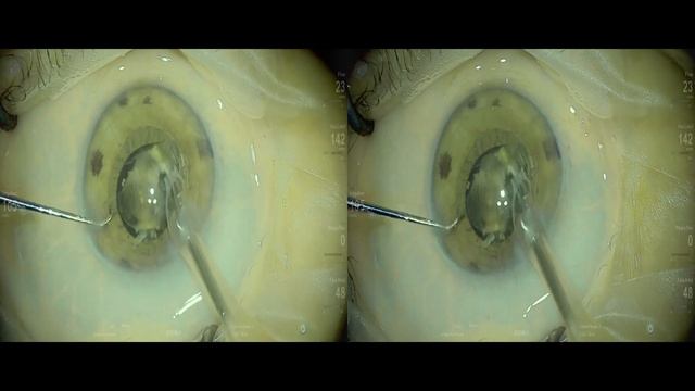 B+L Lux Good Lukan Mishev live stream смотреть онлайн