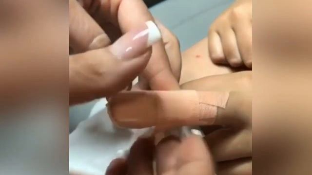 Обрабатываем пальчик подростку? • Делаем повязку смотреть онлайн