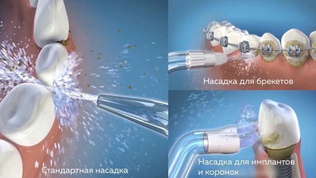 Видеообзор. Портативный ирригатор Waterpik WP-560 EU