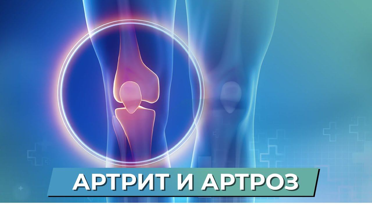 АРТРИТ и АРТРОЗ! Как вылечить артроз без лекарств? смотреть онлайн