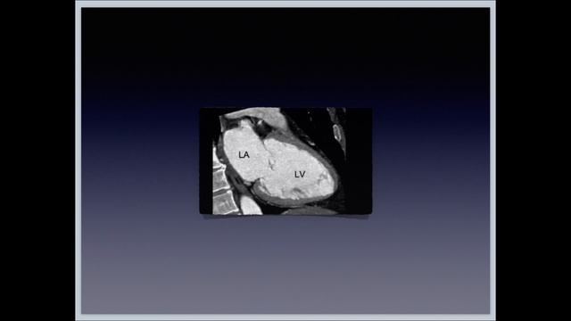 ППС-2-МС смотреть онлайн