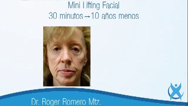 Mini Lifting Facial смотреть онлайн