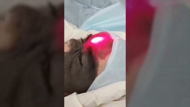 Luna, the girl with the Batman mask- laser treatment procedure смотреть онлайн