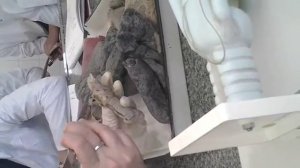 Мышцы гортани