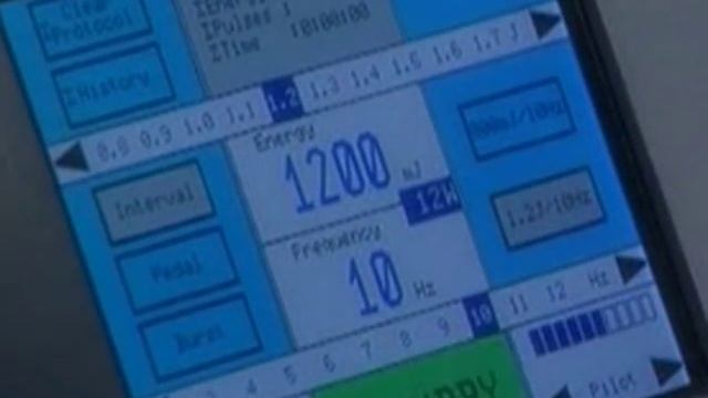 Лазерная литотрипсия смотреть онлайн