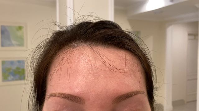 Ботокс лица смотреть онлайн