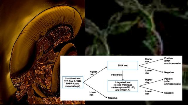 Кто такой Чужой Runner (обзор)Xenomorph