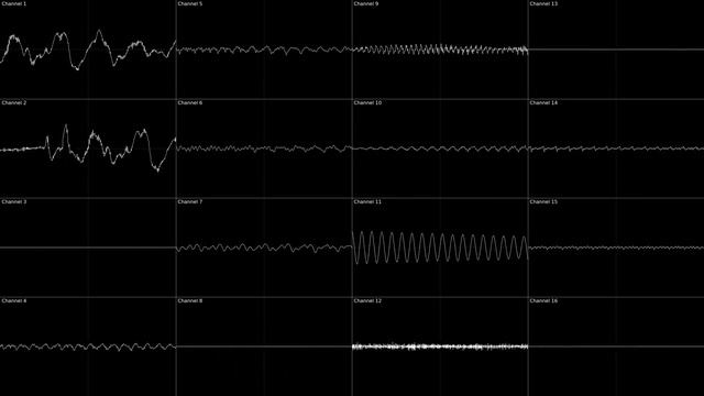 Street Fighter 3: Third Strike (CPS3) - Twelve/Necro Stage Round 1 (Oscilloscope View) смотреть онлайн