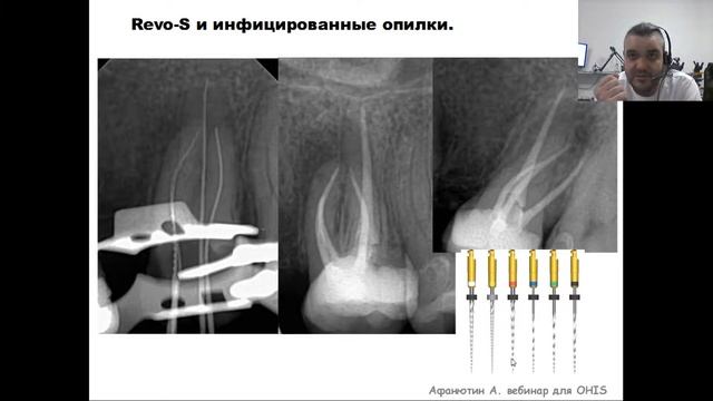 Вебинар №4 - Методики работы каналов смотреть онлайн