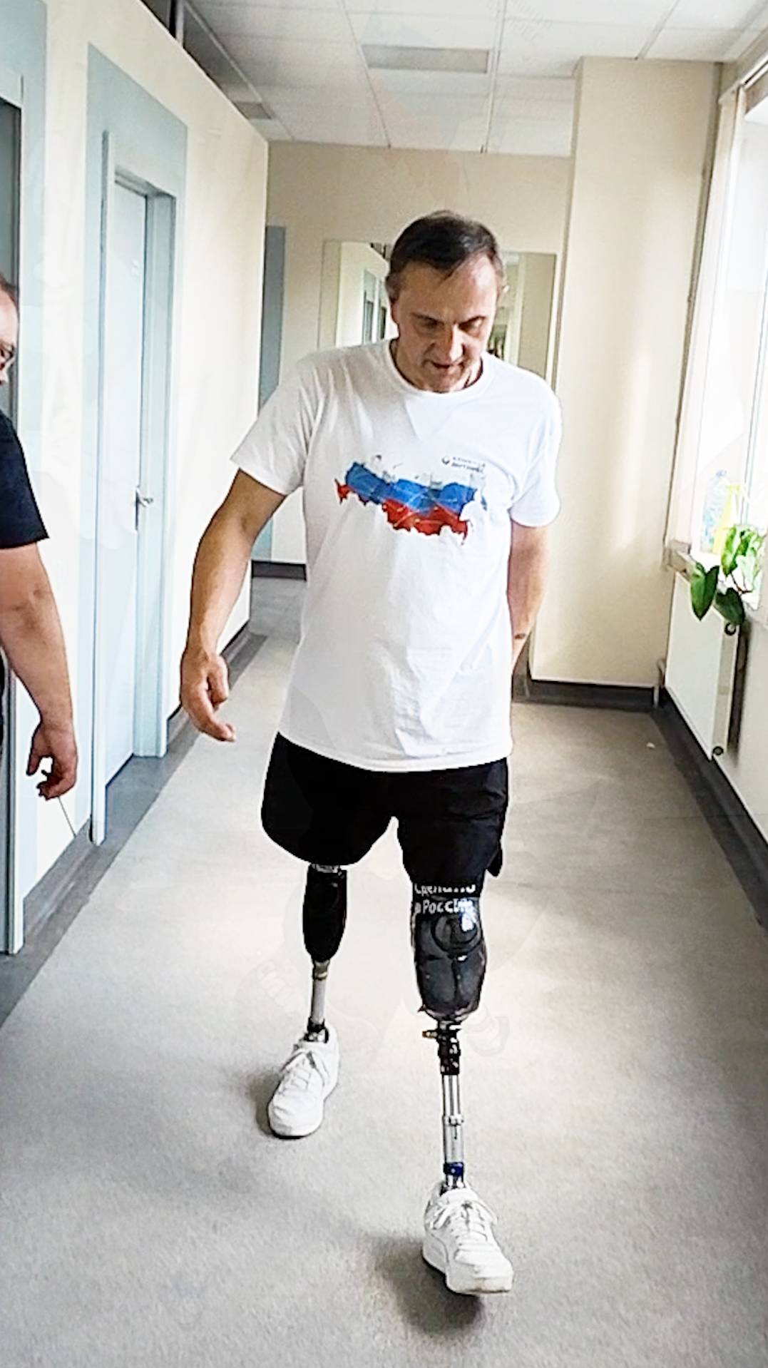 Протезы ног: примерочные гильзы смотреть онлайн