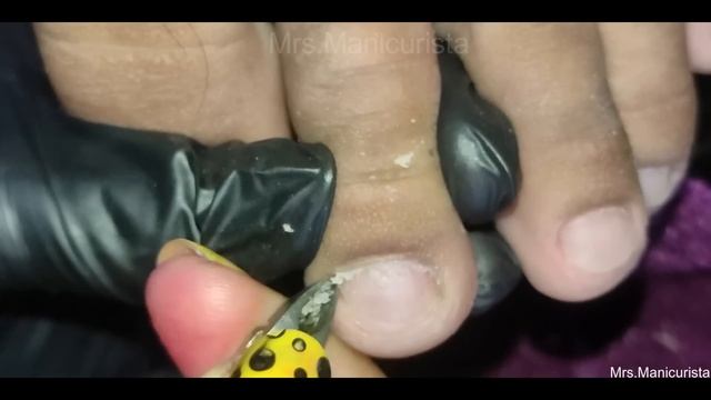 Vlog 740|Dry Skin/Ingrown Removal| PEDICURE 640 смотреть онлайн