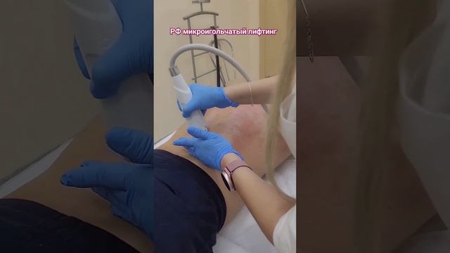 Постакне часто локализуются на спине, зоне декольте на подбородке, щеках и лбу.#спб#красота#питер смотреть онлайн