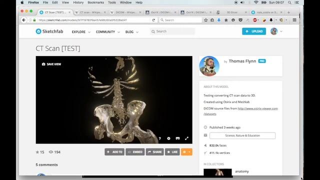 CT Scan DICOM Files to 3D [HD] смотреть онлайн