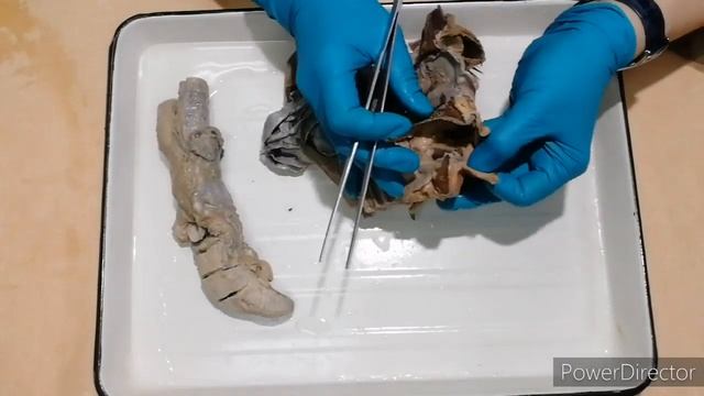 Полость рта губы, щеки, десна, нёбо, дно полости рта, пространства дна полости смотреть онлайн