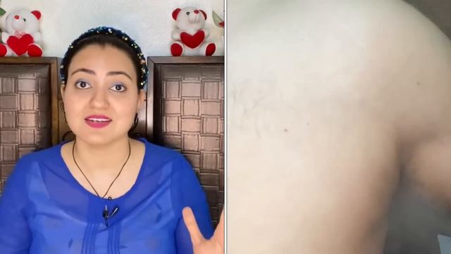 कितने भी पुराने Stretch Marks स्ट्रेच मार्क्स Brown Spots / White Spots को जड़ से 100% खत्म करें смотреть онлайн