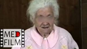 2. Старческое слабоумие © Senile dementia