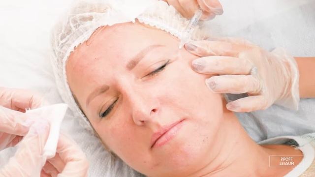 КОНТУРНАЯ ПЛАСТИКА ЛОБ И ГЛАЗА смотреть онлайн