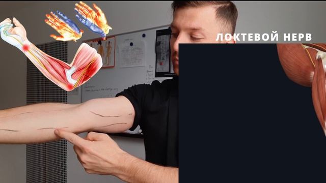 Онемение пальцев рук после сна. Локтевой нерв. Срединный нерв. Растяжки для нервов руки