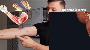 Онемение пальцев рук после сна. Локтевой нерв. Срединный нерв. Растяжки для нервов руки