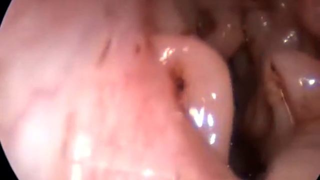 Как удалять инородное тело из кошки? ВетЭндоШкола www.endovet.ru смотреть онлайн