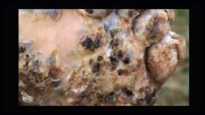 Jiggers Torn Off l One Of Th Feet In Africa