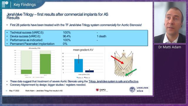 EuroPCR 2022: ALIGN-EFS Finds 100% Procedural Success Rate Using JenaValve Trilogy in Pts With AS смотреть онлайн