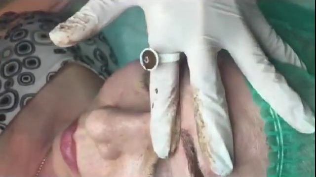 Микроблейдинг