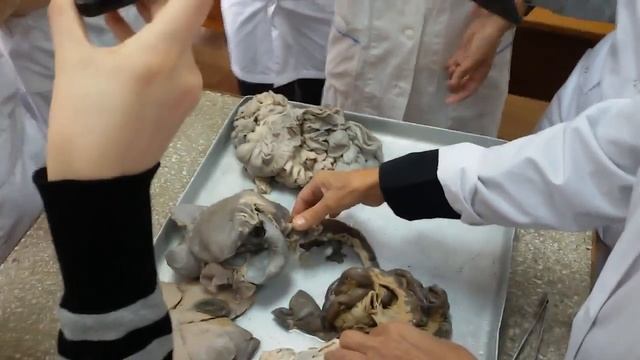 Анатомия печени, тонкой кишки смотреть онлайн