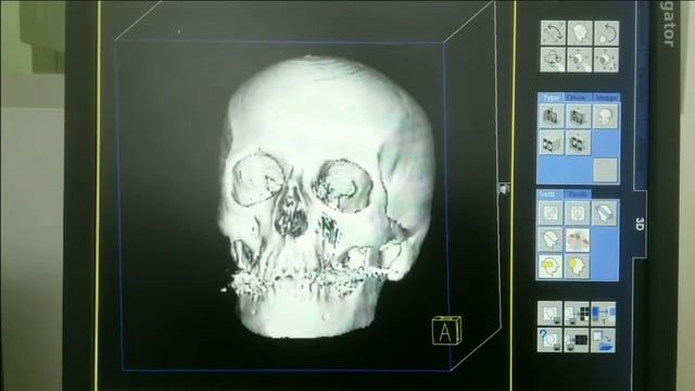 КТ в Анапе. Высокие технологии Компьютерной томографии. смотреть онлайн