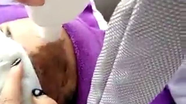 MV2008 карбоноый пилинг смотреть онлайн