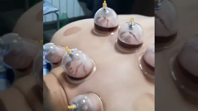 МАССАЖ,ХИДЖАМА,АЛМАТЫ АКСАЙ4 ДОМ 58,САЛОН RICH